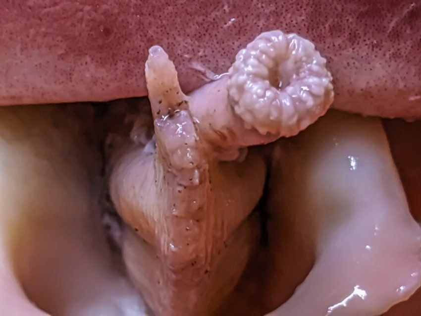 Close-up of pink flesh with a white curled tubular shape against a reddish background; glossy, wet texture.